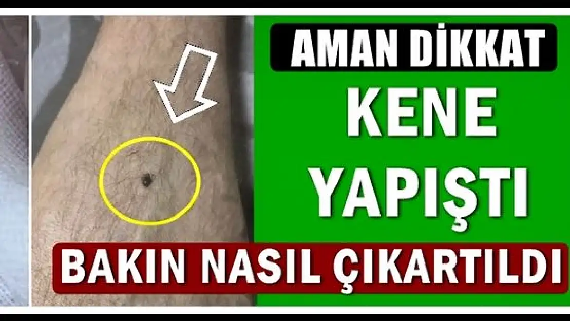 Piknikte baldırına kene yapıştı