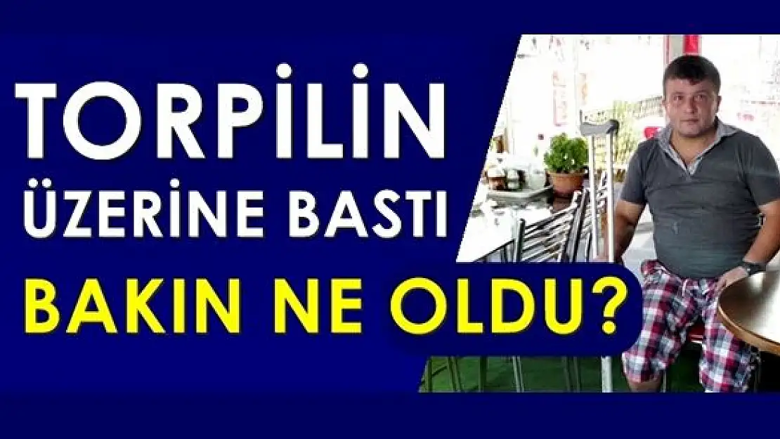 Torpilin üzerine basınca olan oldu!