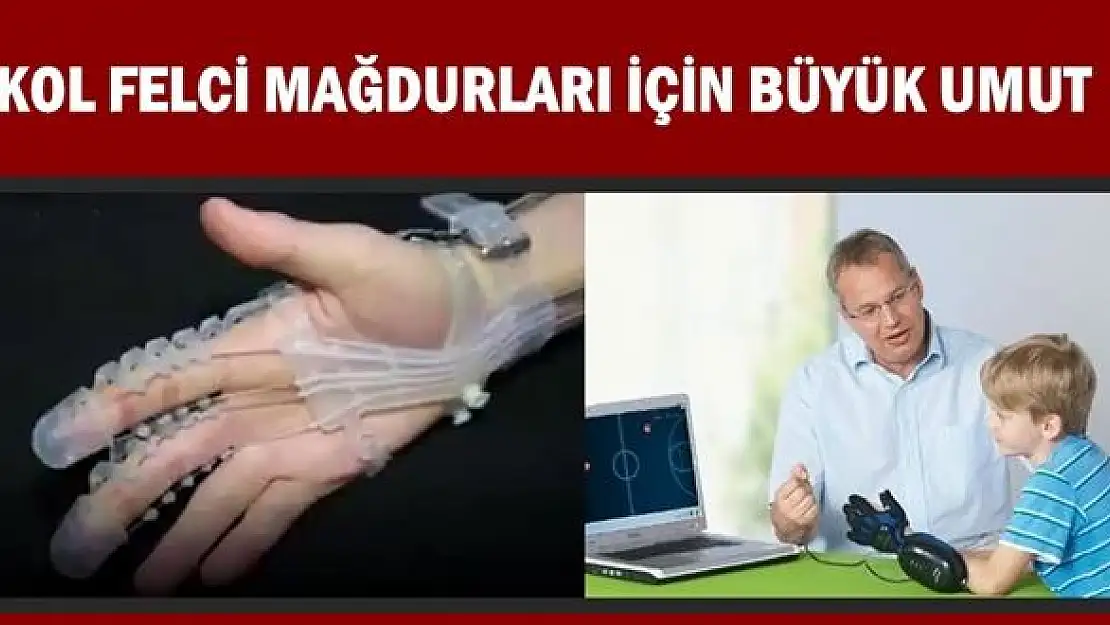 Türkiye'nin ilk yerli robot el projesi destek bekliyor !