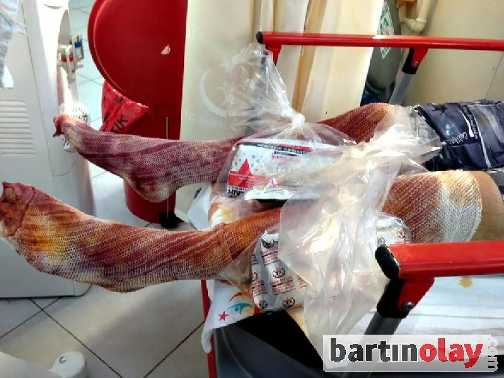 Teknede patlama, 1 yaralı