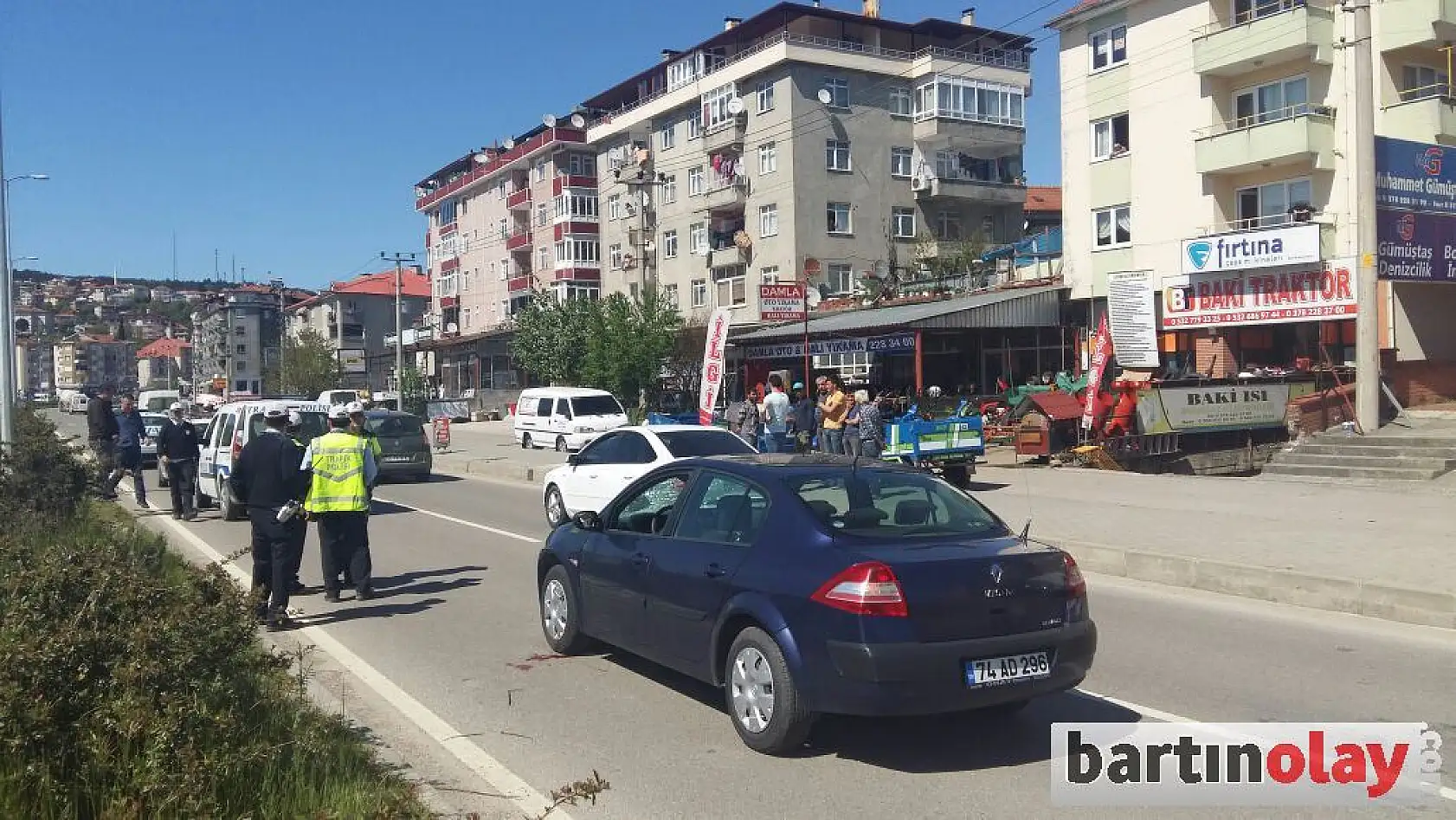 Yolun karşısına geçmek isterken araba çarptı