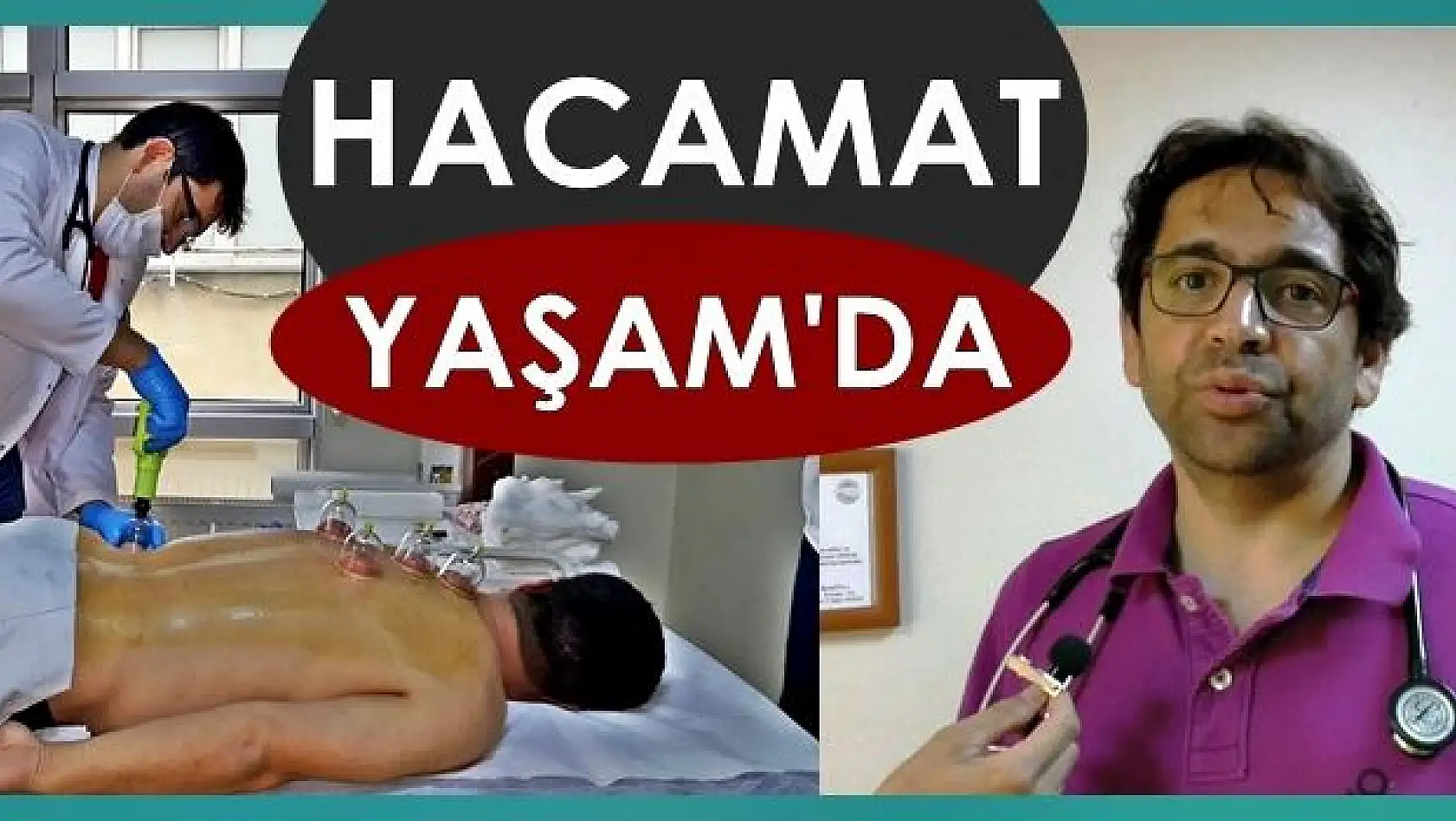 Bartın'da Hacamat Yaşam'da 