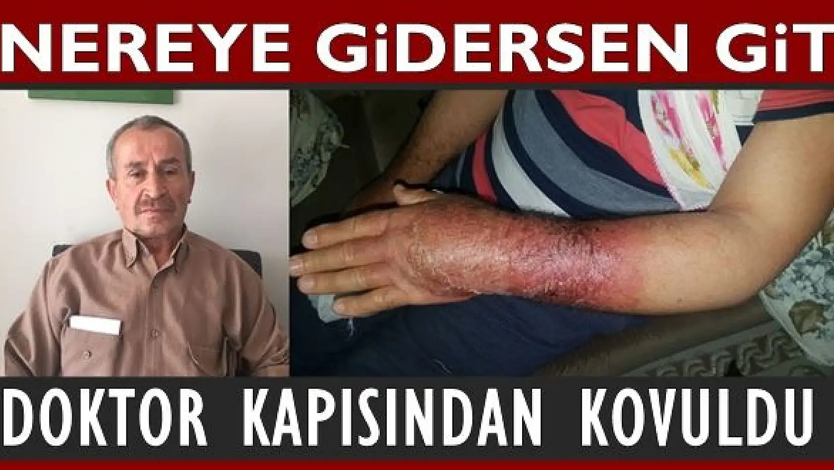 Bu Vaziyette Doktor Kapısından Kovuldu