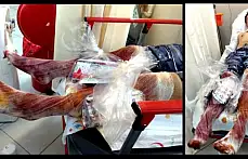 Teknede patlama, 1 yaralı