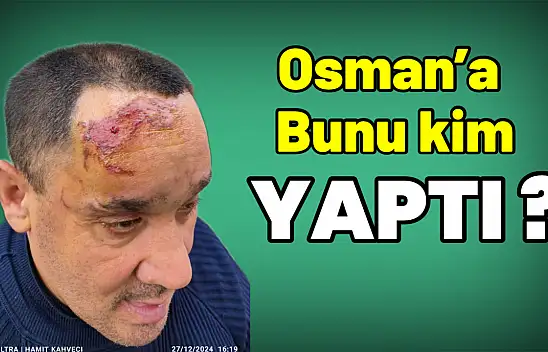 Osman'a bu yapılır mı?