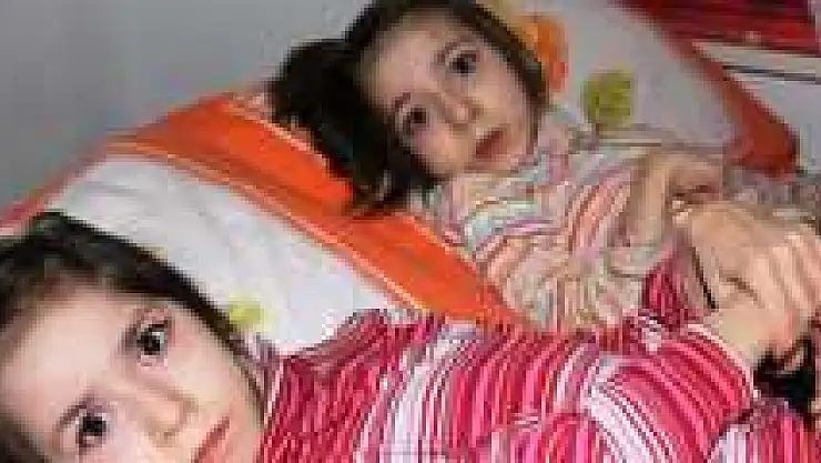 İkizlerin Dramı Yürekleri Dağlıyor