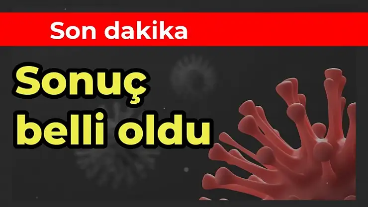 İşte merakla beklenen test sonucu