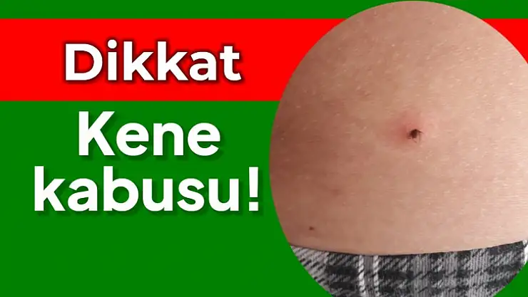 Kene kabusu başladı