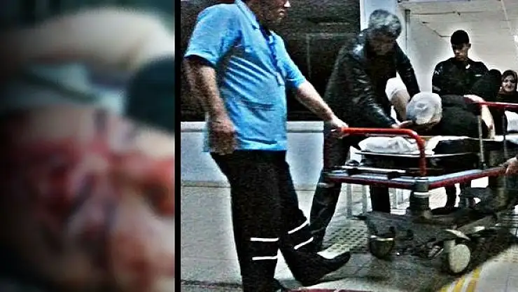 Motosiklet kazası, 1 ağır yaralı