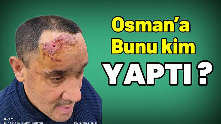 Osman'a bu yapılır mı?