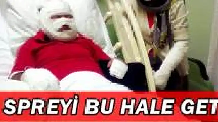Patlayan Oda Parfümü Karı Kocayı Yaktı