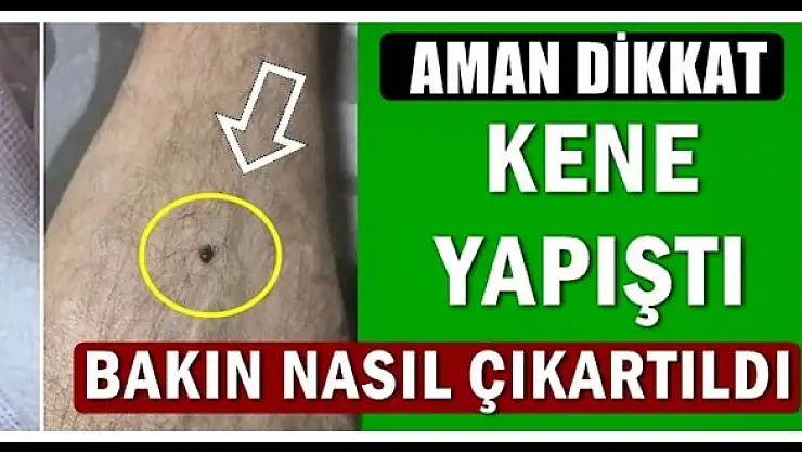 Piknikte baldırına kene yapıştı