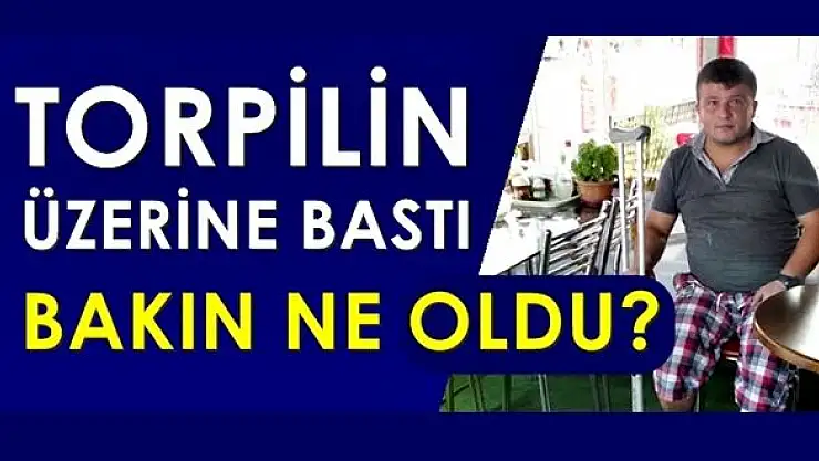 Torpilin üzerine basınca olan oldu!